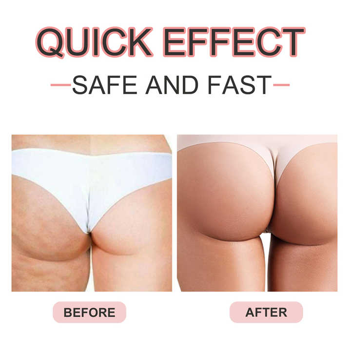 Parches Reafirmantes "Hip Lifter" – Tratamiento Intensivo de Levantamiento y Firmeza (Pack 2 pzas)