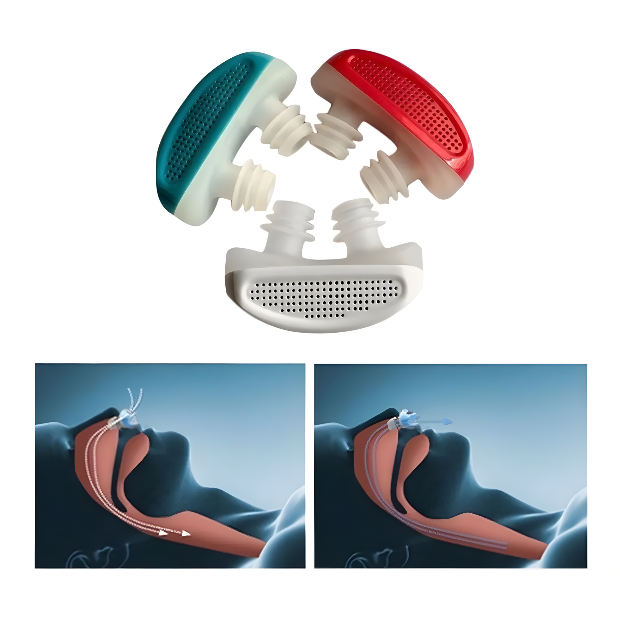 Dispositivo Antirronquidos para Dormir Mejor y Reducir Ronquidos